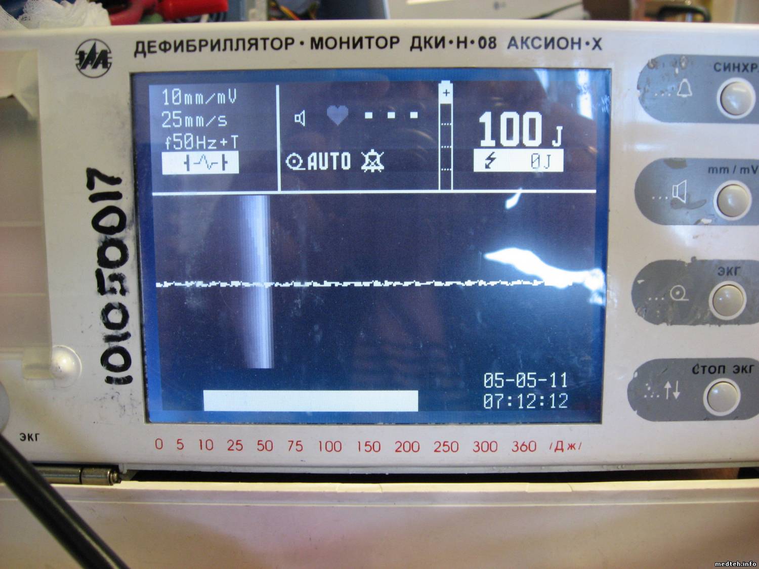 Дефибриллятор-монитор