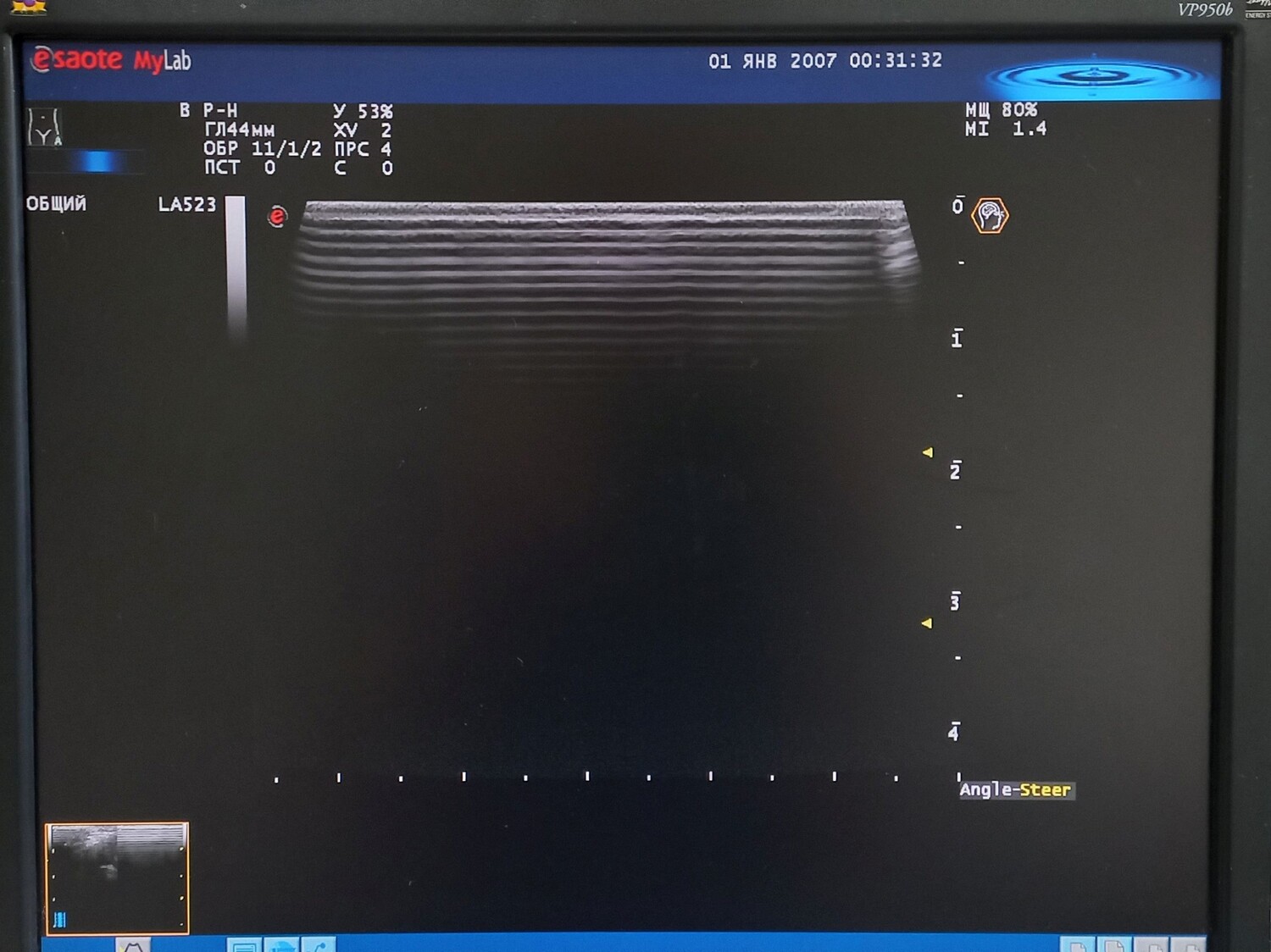 Линейный датчик Esaote LA523